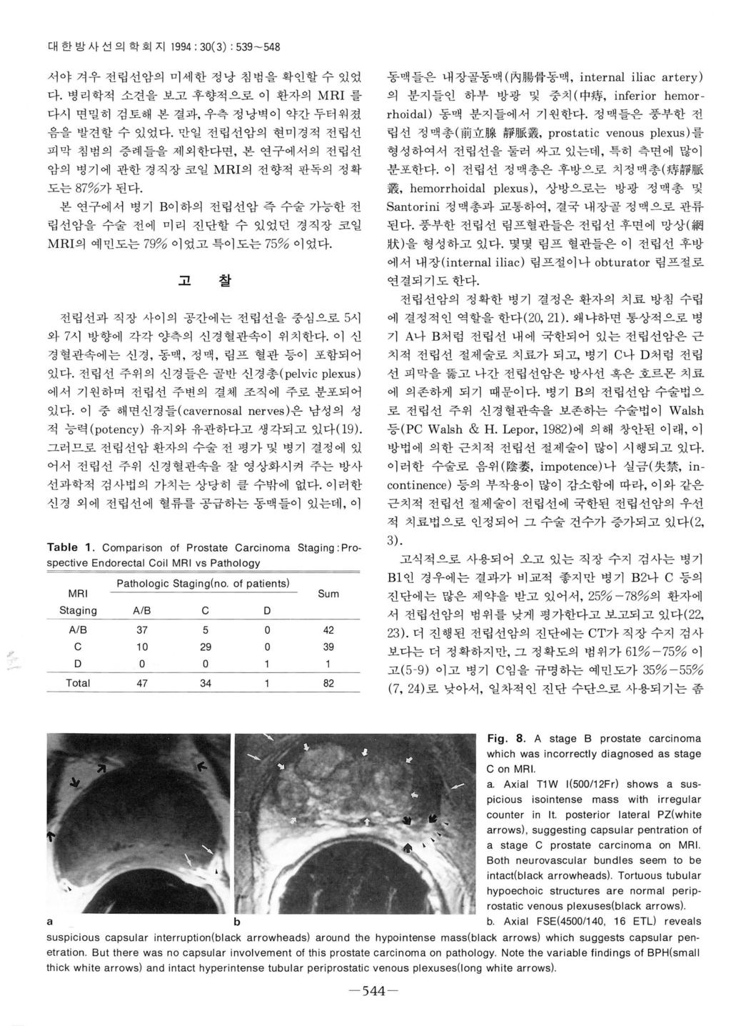 대한방사선의학회지 1994 : 30(3) : 539-548 서야겨우전립선암의미세한정낭침벙을확언할수있었 다.