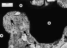 (Undecalcified, H&E, staining, 40) White circles indicate the Cerabone A- 13) W implant, black arrows indicate newly formed bone Fig 7 Histologic results of