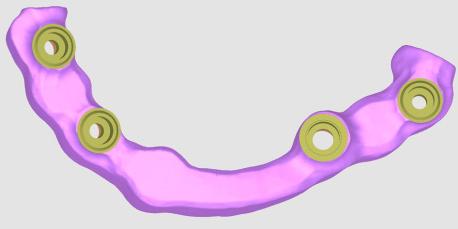 tightening by 20 Ncm torque. A B C D Fig. 6.