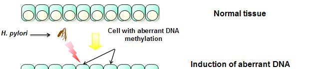 DNA Methylation and ene Silencing in Cancer Cells DNA