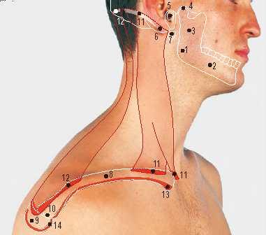 6 Point of access to internal jugular vein above sternocleidomastoid muscle 7 Point of access to internal jugular vein between the heads of the sternocleidomastoid muscle 8 Collar incision 9