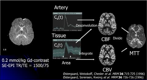 pmri: DSE or T2*W PWI Common outputs: CBF, CBV, MTT, Peak height, Percent signal recovery 조영제의주입으로 Susceptibility( 자화감수성 ) 이증가하며, T2* 신호가감소하게됨. 이감소를시간에따른 T2* relaxivity contrast 변화 ( R2*) 로나타내게됨.