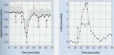 Peak signal change D. Recirculation E. Post-injection baseline A. Arrival time B. Maximum contrast concentration C. Full-width at half maximum Book by A.G. Sorensen & P.