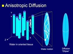 Diffusion Tensor Imaging (DTI) Fractional Anisotropy Mean Diffusivity E 1 E 2 T1-weighted E 3 Directionality Linear diffusion C li : λ1>> λ2 = λ3 Planar diffusion C pl : λ1 =