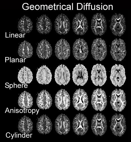 uk)- TBSS(Track-based spatial statistics) 등과같은프로그램을이용하여하는것을 특정선행가설이없어도사용가능.