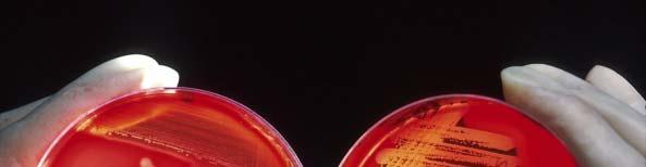 1-3 배지 - 미생물성장에필요한영양분함유 - 미생물분리동정가능 - 항생제감수성측정 - 조성은미생물마다다름 1) 제한배지 (defined medium), 합성배지