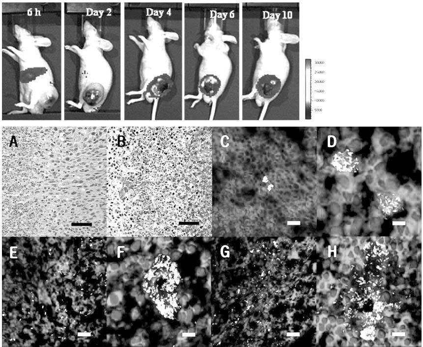 1) IRES (IRES based approach) internal ribosomal entry sites (IRES)... IRES. 6.. lux, 6. GFP. H&E (A) Gram (B), DAPI, Texas red F-actin (C-H) 1 (C, D), 5 (E, F), 7 (G, H).