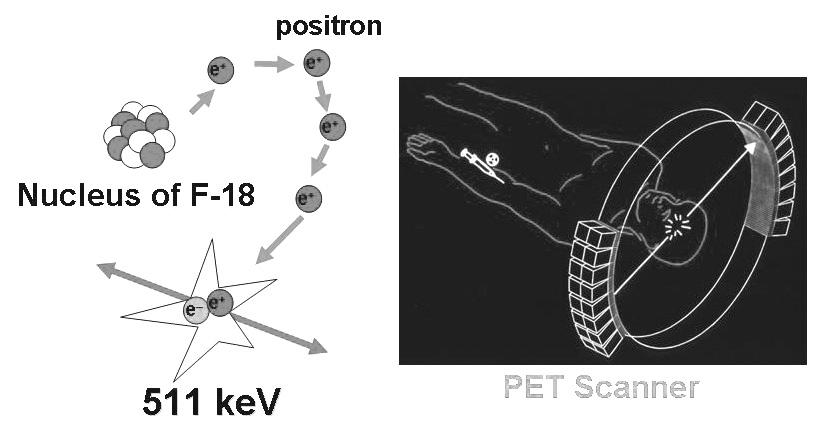 PET (specific marker).,, natural biological molecule,, molecular probe, reporter probe, marker, tracer. PET, molecule. probe PET, ( 2). [ 18 F]2-deoxy- 2-fluoro-D-glucose (FDG) fluorine-18 ( 18 F).