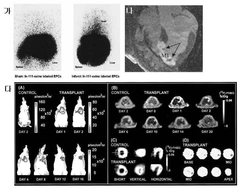 , 48 75%.,,. 2) MRI MRI. MRI,.,,, 2., MRI, (30). 3) PET,.,.,,,., (31). (2) Bacterial luciferase in vivo (In Vivo 5.. ( ) In-111.,. ( ) MRI.. ( ) firefly luciferase PET HSV1-tk, PET.