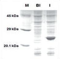 실험결과 1. 목적단백질발현세포준비 M BI I 45 kda 29 kda 20.1 kda Figure 1. Recombinant E. coli cell with expressed of DUSP3.