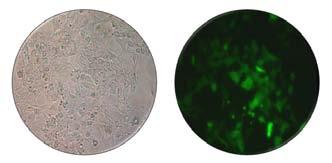 실험결과 1. 목적단백질발현세포준비 Light Fluorescent Figure 1. Light and fluorescent microscope images of HEK293 cells.