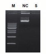 DNase PK 66 45 29 M: AccuLadder Protein Size Marker (Low), NC; Negative control (No-DNA), PC; Positive control (AcGFP), DNase; DNase I, PK; Proteinase K 20.1 5.