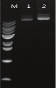 5.2. ExiProgen kit 를이용한막단백질합성 일반적으로막단백질은일반적인 E. coli 발현환경 (in vivo 또는 in vitro) 에서는발현되기어려우며, detergent 를첨가해주어야합성이가능합니다. 당사의 ExiProgen 단백질합성 kit 를이용하면 detergent 첨가만으로도손쉽게막단백질을합성할수있습니다.