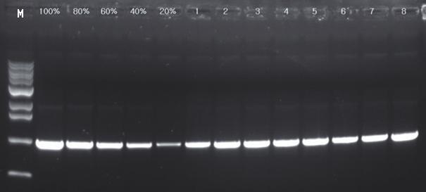 AccuPower ProFi Taq PCR PreMix (K-2631, Bioneer) 와 MyGenie 96 Gradient Thermal Block (A-2040-1, Bioneer) 를사용하여 PCR 수행후예상크기가 500 bp인 DNA를합성하였습니다.