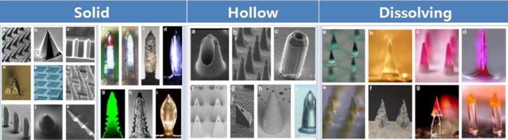 Microneedle types SOLID HOLLOW DISSOLVING Drugs are coated over the outer layer of