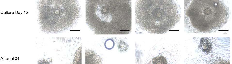 Profiles of micrornas in Mice Follicles According to Gonadotropins during in vitro Culture. Korean J Reprod Med 2009.