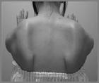 impingement in athlete SLAP & Scapular dyskinesis Shoulder at risk :