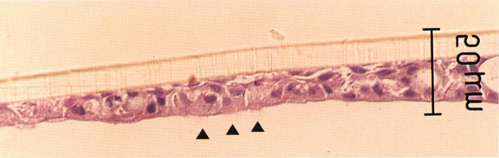 합 에 레티노익산이 어떠한 영향을 미치는지 관찰해 보았다. 류 7일 후 진주종 상피 세포는 각질 중층 편평 상피 세포 로 분화되었으며(Fig. 1A), 이는 stratum basale, stratum spinosium, stratum granulosum, stratum cornium으로 구성되어 있어 생체내의 진주종 조직과 유사하였다.