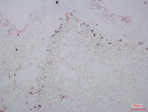 이비정형체의정확한조직학적특성을파악하고자현미경관찰을실시한결과 Figure 3D 의오른쪽하단과같이뿌리및잎등과같은기관에서나타나는통도조직이잘발달하고있었다.