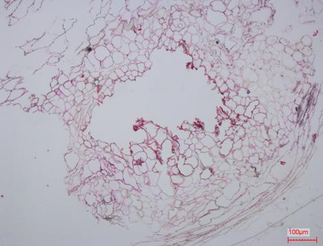 3 Microscopic observation of new embryogenesis from atypical bodies appeared during the process of long-term subculture of embryogenic calluses