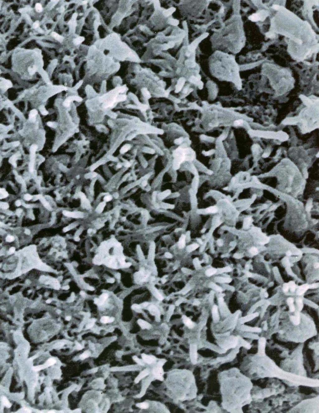 Micrograph showing crowded olfactory vesicles. Most of sustentacular cells are disappeared 1306 Fig. 8.
