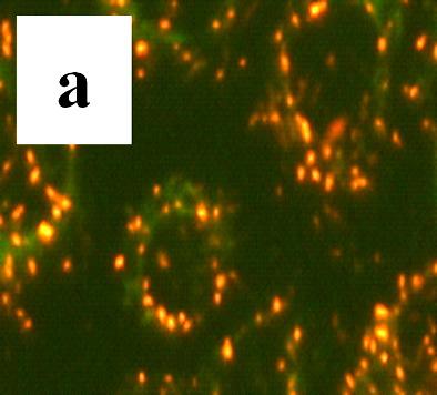 FK506 treated cells were stained with 10μg/ml of JC-1 visualized under a fluorescent microscope. (a) Control cells, and (b) FK506 treated cells for 36 hrs.