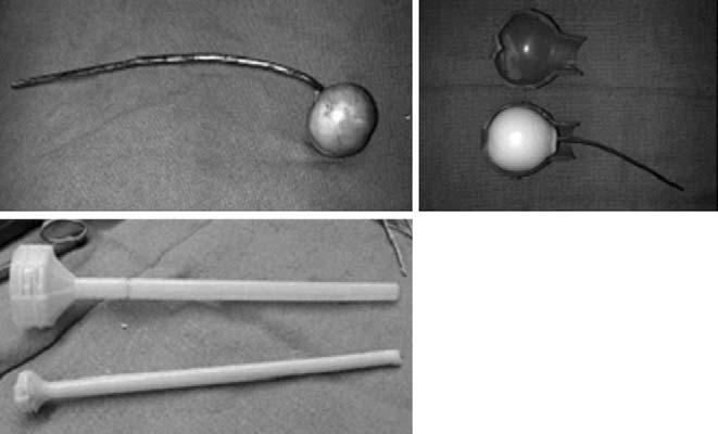 spacer. Fig. 1. The metal mold, made of stainless steel, used to make the femoral component of the cement prosthesis. Fehring 등 19) 은 4.