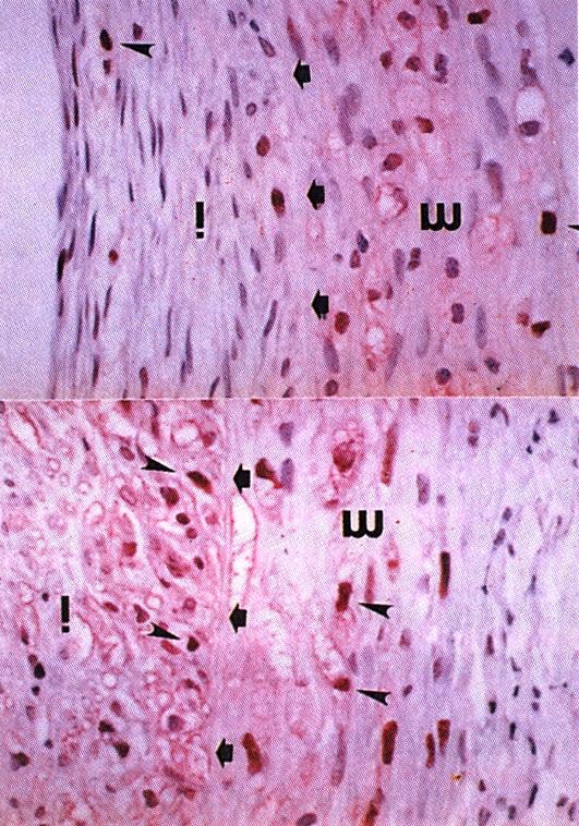 Intimal and medial hyperplasia are more prominent in hypercholesterolemic than in normocholestrolemic rabbit. The intima (i), media (m), and internal elastic lamina (arrow) are indicated.