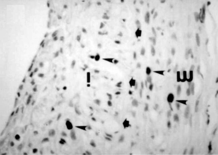 The proliferative activity is higher in hypercholesterolemic than in normocholesterolemic rabbits especially on 14 days after