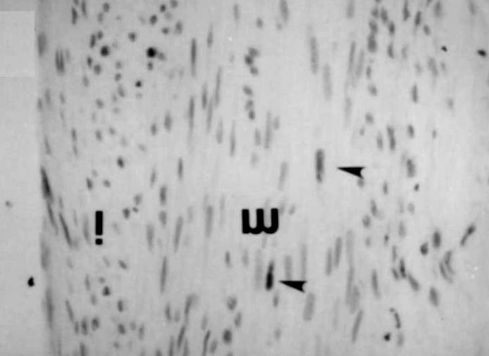 4. PCNA index (%) of intima and media of hypercholesterolemic (HC) and normocholesterolemic (NC) rabbits 1, 3, 7, and 14 days after