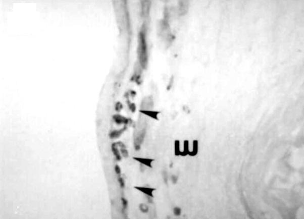 E, F, G and H Hypercholesterolemic rabbits at day 1, day 3, day 7, and 