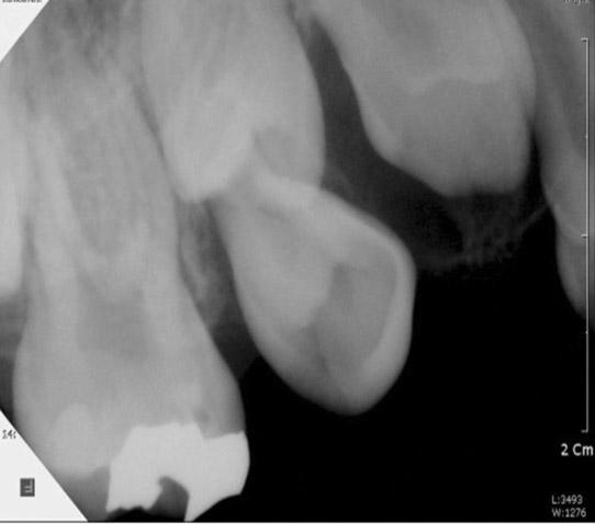 (a) Initial 3-Dimensional CT image.