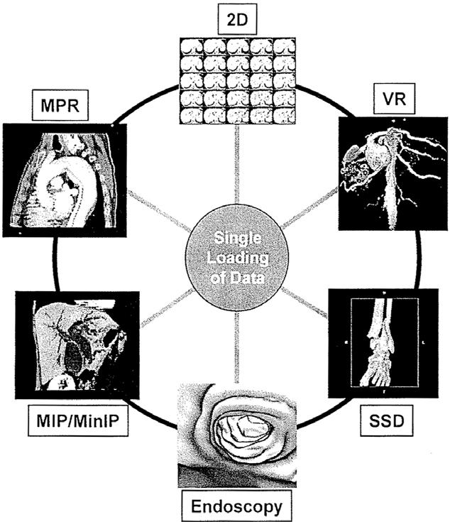 1.5 주기능및역할 Image Loading - DICOM compatible, DICOM Query - Patient / Series / Image selection - Options : ROI (Region of Interest), Patient orientation, Image resolution, Display mode, Study name,