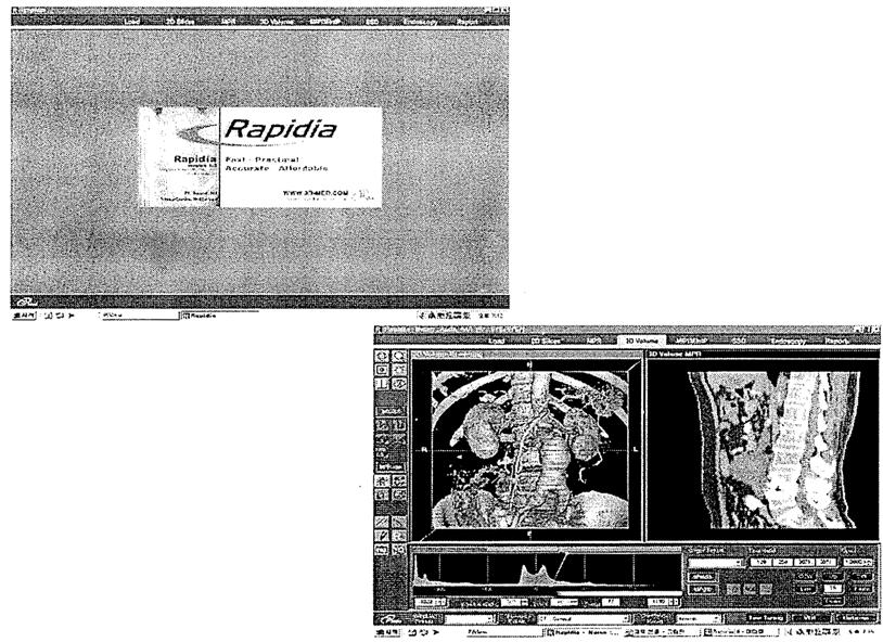 II. 기술개발내용 1. 제품의개요 1.1 개발제품명 : 래피디아 (Rapidia = Rapid+Diagnosis) 1.2 개발제품 U.I. 1.3 제품의작동원리 CT/MRI 2치원영상을 LOAD한후 3 차원영상을위한전처리과정을한다. Volume rendering module은 ray casting기법을이용하여 3 차원영상을만든다.