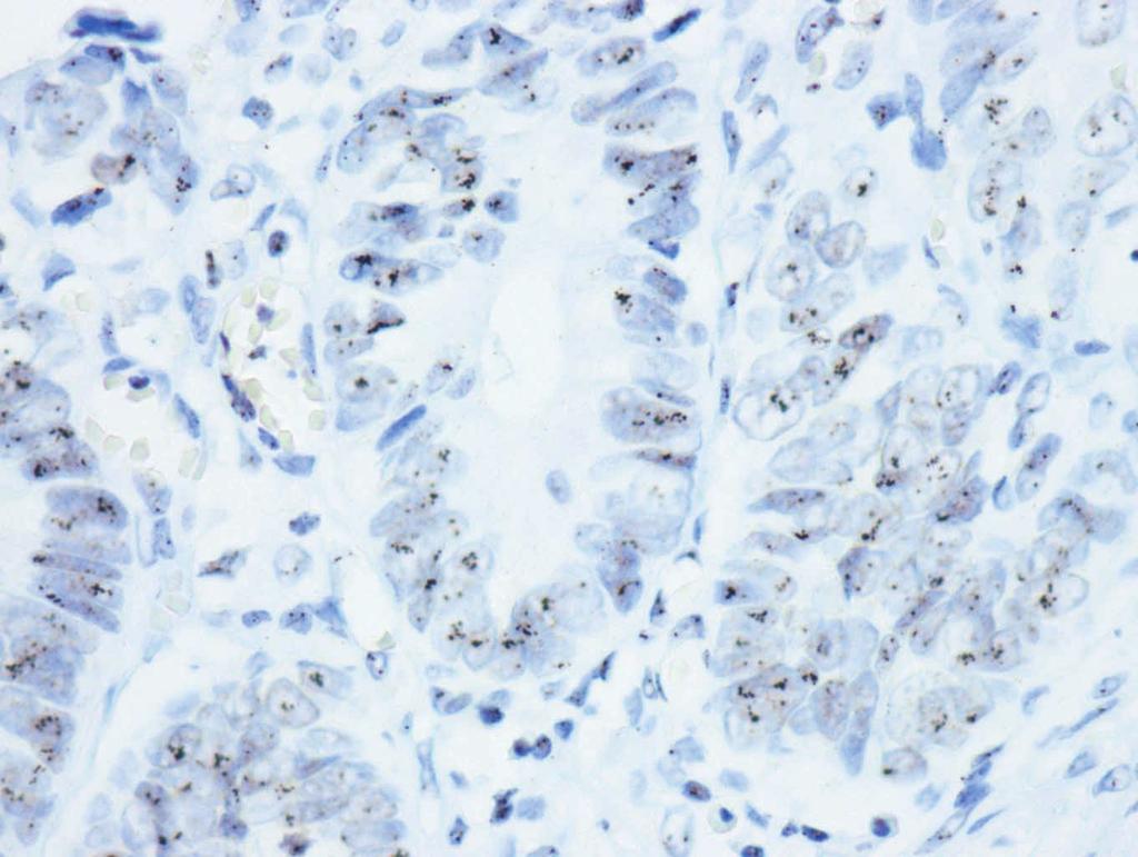 Comparison between immunohistochemistry (IHC), silver-enhanced in