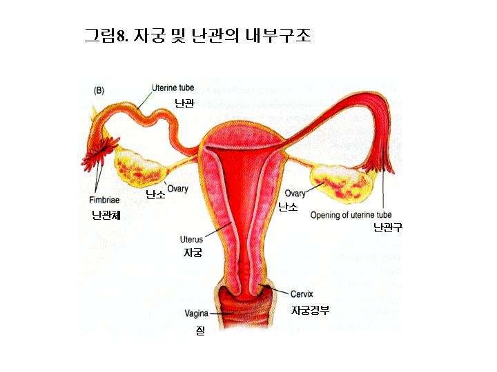 여자 난관팽대부, 협부 난관팽대부 -