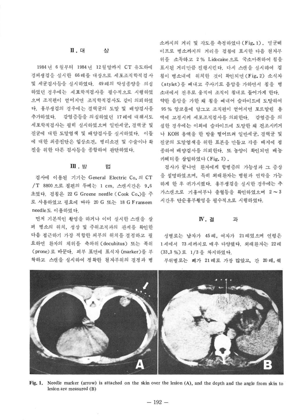 ll. 대 Af 그 1984 년 6 월부터 1984 년 1 월말까지 CT 유도하에 경피생겸을실시한 66 려1 플대상우로세포조직학적경사 및세균겸사등을실시하였다 49 례의악성종양을의심 하였던경우에는세포학적검사를필수적 로시행하였 으며조직편이 얻어지띤조직학적검사도같이의뢰하였 다. 흉부생겸의경우에는결핵균의도말및배양검사를 추가하였다.