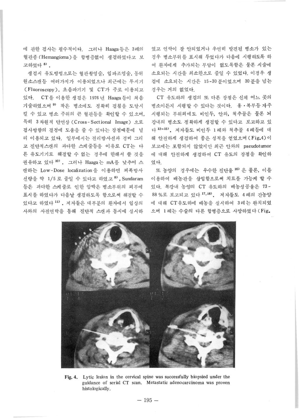 어l 관한검사는필수적이다. 그러나 Haaga 등은 3 례의혈관종 ( Hemangioma) 을합병증없이생겸하였다고보고하였다 8) 생검시유도방법으로는혈관촬영술, 임파조영술, 동위원소스캔등여러가지가이용되었으나최근에는투시기 C Fluoroscopy).