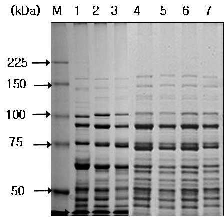 Figure 2. Whole cell protein patterns of Leuconostoc mesenteroides between the LAB isolates from fermented foods and the reference strains by SDS-PAGE analysis).