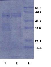 하게나타났고 fraction 45번과 51 번에서약간의활성이나타났다. Ginsenoside Rd생산효소 활성이가장강하게나타난 35번 fraction을중심으로양쪽옆으로 fraction 순서대로 33번 부터 37번 fraction 까지 Rb1 과반응시켰다. 반응결과 Fig. 67과같이 35번과 36번 fraction 에서가장강한할성을보였다.