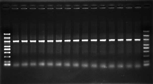 Electrophoresis of chromosomal DNA by benzyl chloride method.