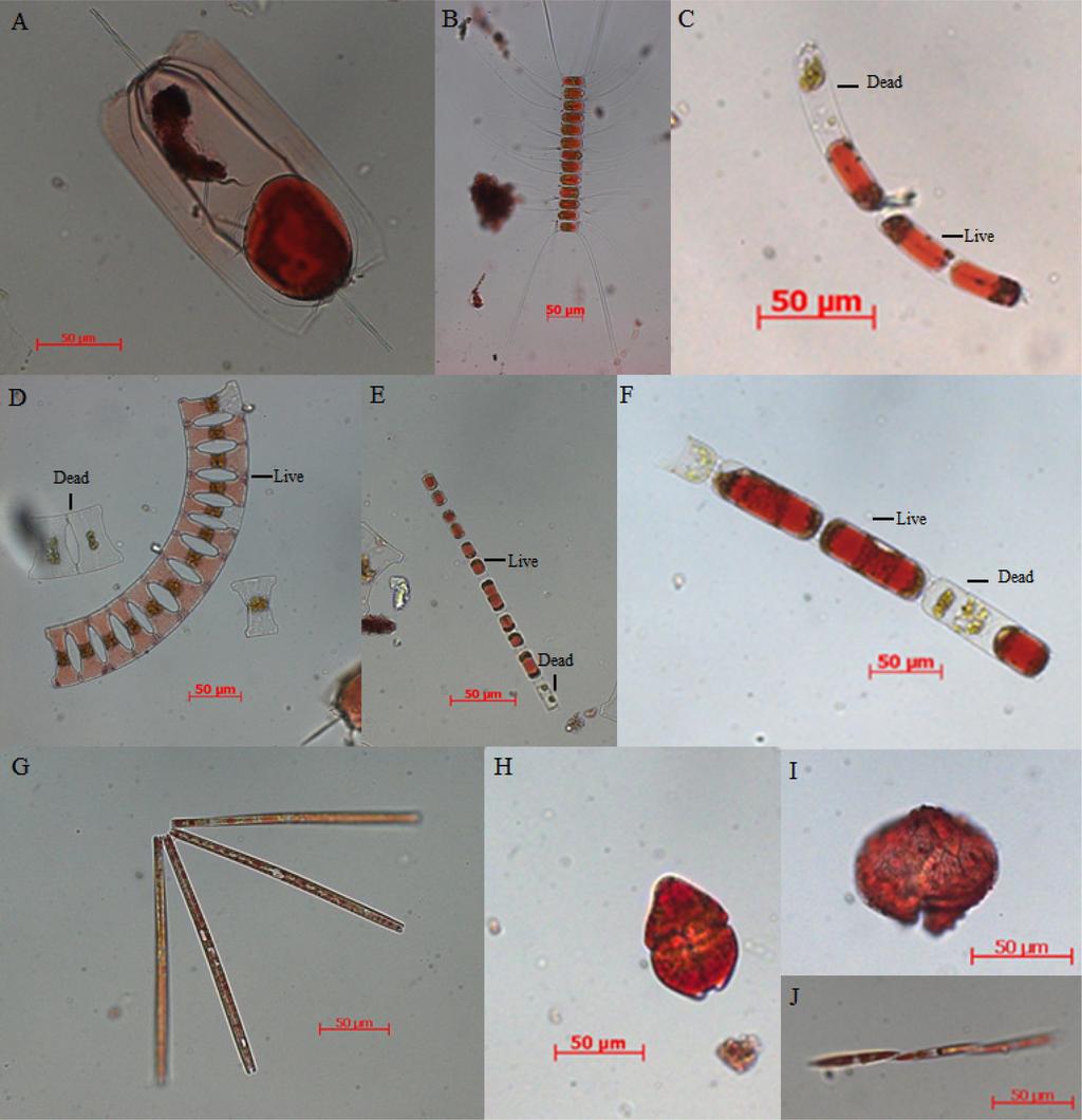 228 현봉길 신경순 정한식 최서열 장민철 이우진 최근형 Fig. 2. Various phytoplankton species from Jangmok Bay stained with Neutral red (NR). (A) Ditylum brightwellii; (B) Chaetoceros sp.; (C) Cerataulina sp.