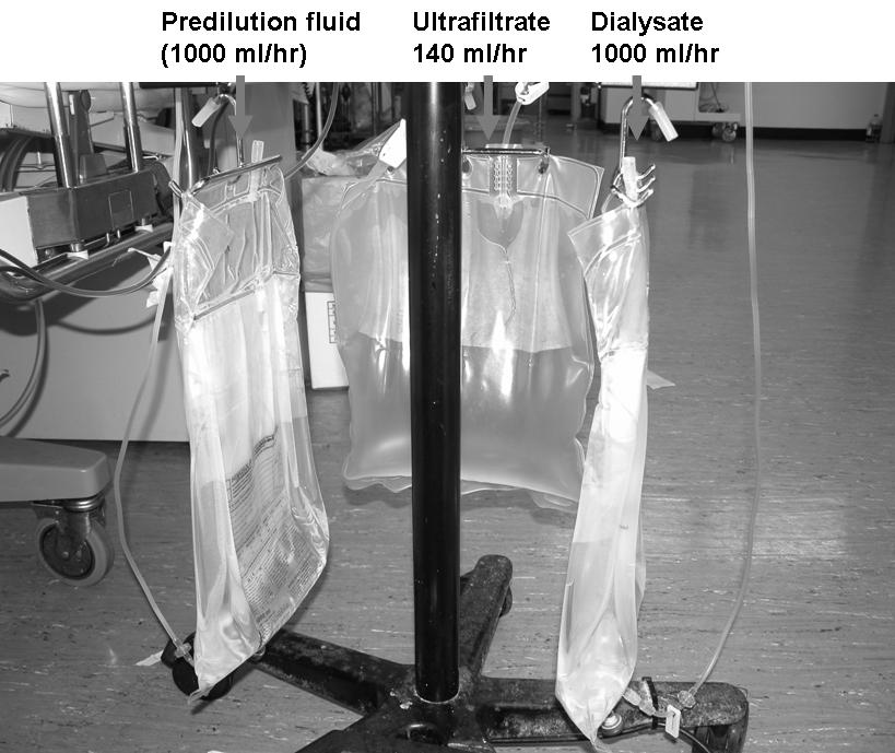 혹은 Slow Continuous Procedures) : 혈류역동학적으로불안정한환자에서혈액투석과비슷한방법을사용하여증가된체액, 요독, 싸이토카인등을매우서서히제거하는 ( 일반적인혈액투석은 4 시간이지만이것은하루 24 시간계속진행함 ) 치료임. 적절한투석을유지하면서도저혈압유발을최소화할수있는방법이다.