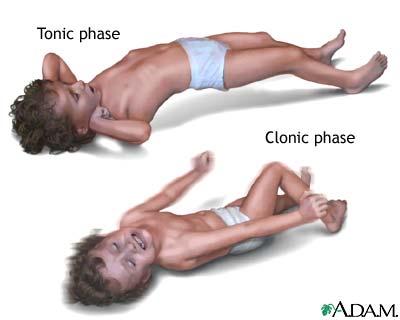 Case 3 A 6-year-old boy is brought to the ER because of severe vomiting.