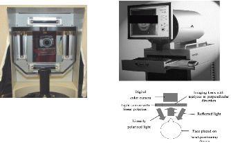 18 빛의광학적특성을이용한영상화기법을이용한것으로 4개의우드등이배치되어있고중앙에는얼굴에일정한광량을줄수있도록배치되어있는 DermaVision-PRO (Coolpix 8400,Nikon, Tokyo,Japan) 를이용하였다 (Figure3).