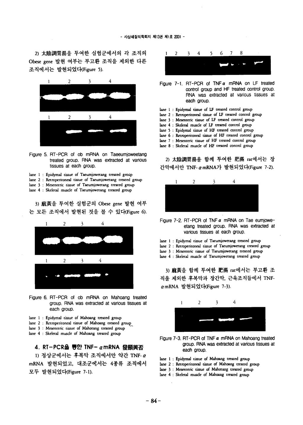 - 사상혜철의확회지쩨 1 권쩨 l 효 I J 1 - ) 太陰謂뽑陽을투여한실험군에서의각조직의 5 6 7 8 O b e s e g e n e 발현여부는부고환조직을제외한다른 조직에서는발현되었다 { F i g u r e 5 ) F i g u r e 7-1 A T - P C A o f T N F a m A N A o n L F t r e a t e d n t r