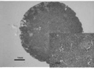 ECM scaffolds: Artificial cartilage looks grossly like hyaline