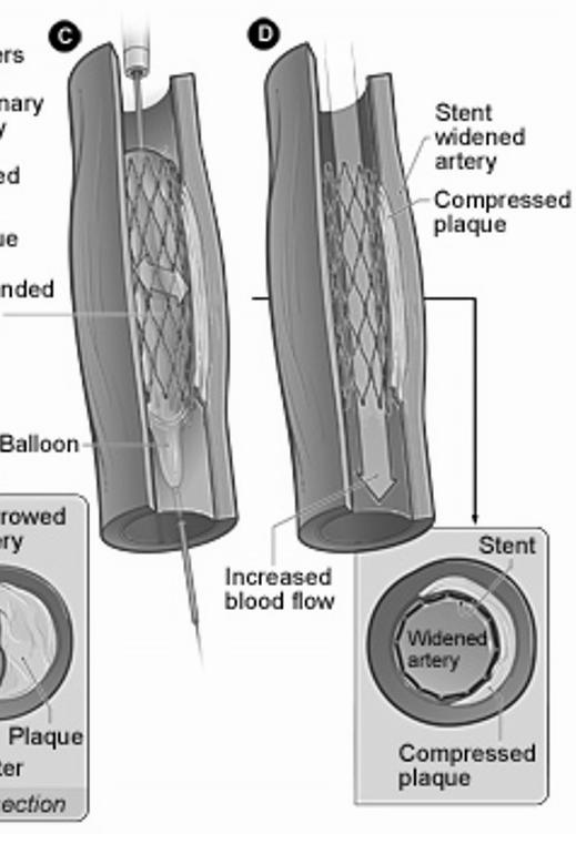 abbottvascular.com, www.hri.