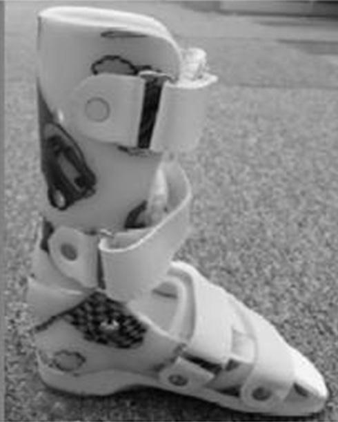 Effect of Hinged Ankle-Foot Orthosis on Walking Function JKPT Assessed for eligibility (n=39) Enrollment Randomized (n=32) Excluded (n=7) Not meeting inclusion criteria (n=4) Refused to participate