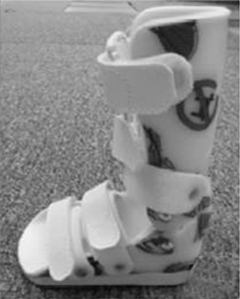 B Hinged ankle-foot orthosis condition Walked through 10 meters of the gait platform with hinged ankle-foot orthosis in three trials Non-Hinged ankle-foot orthosis condition Walked through 10 meters